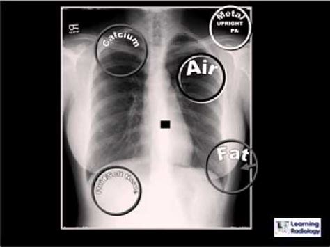 apicolordotic meaning tagalog|Translate apicolordotic view in Tagalog with examples .
